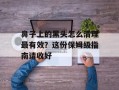 鼻子上的黑头怎么清理最有效？这份保姆级指南请收好
